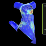 Children’s Hospital Uses Open Source NVIDIA AI for Cardiac Care