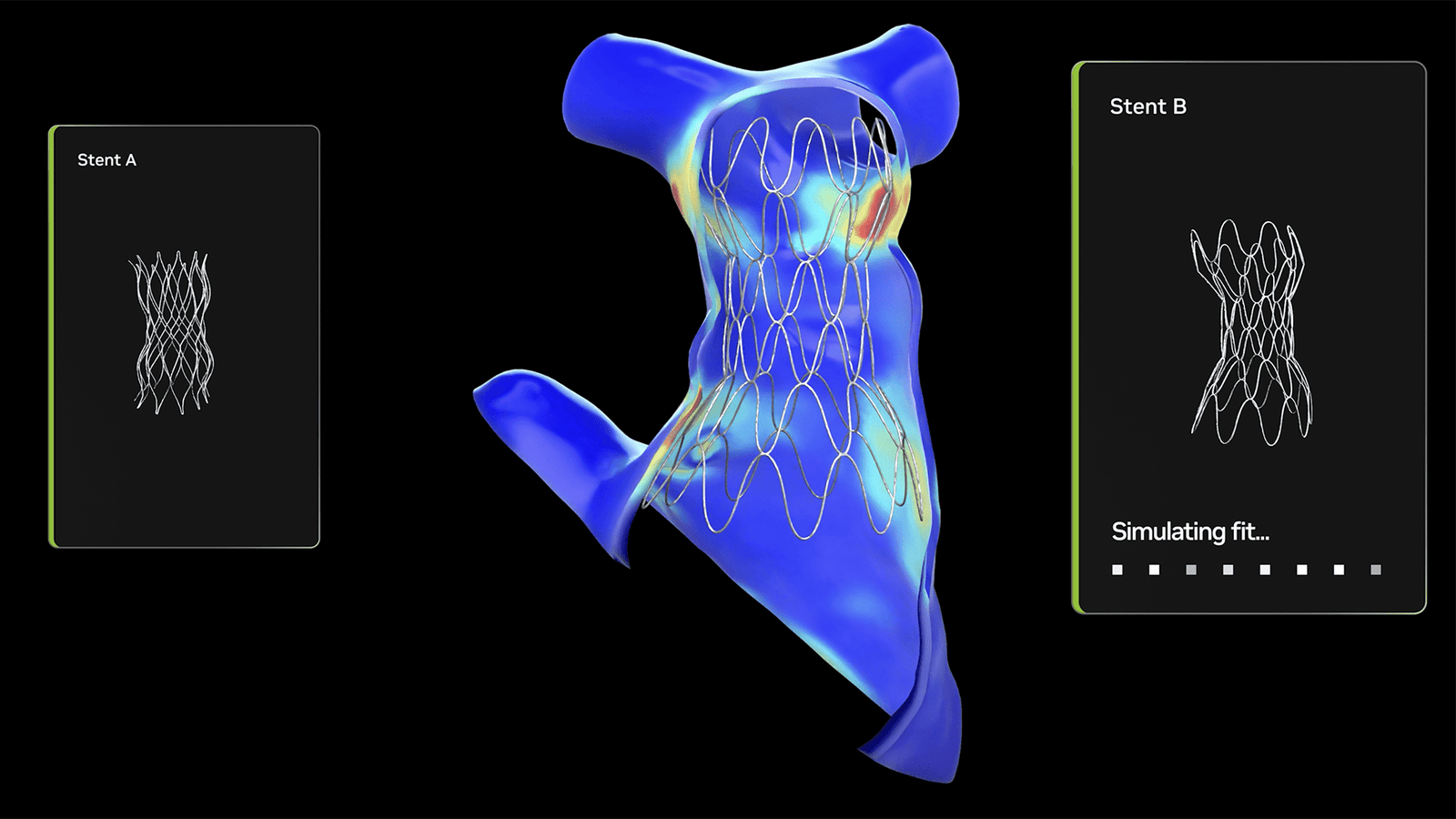 Children’s Hospital Uses Open Source NVIDIA AI for Cardiac Care Children’s Hospital Uses Open Source NVIDIA AI for Cardiac Care