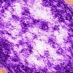 Measles: Adult woman dies amid growing Pennsylvania outbreak